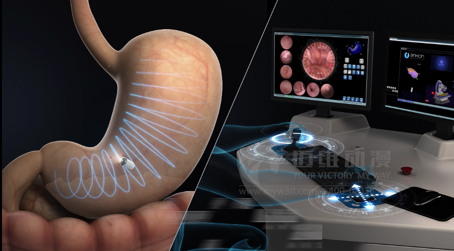 醫(yī)學(xué)醫(yī)療三維動畫 醫(yī)學(xué)醫(yī)療三維動畫