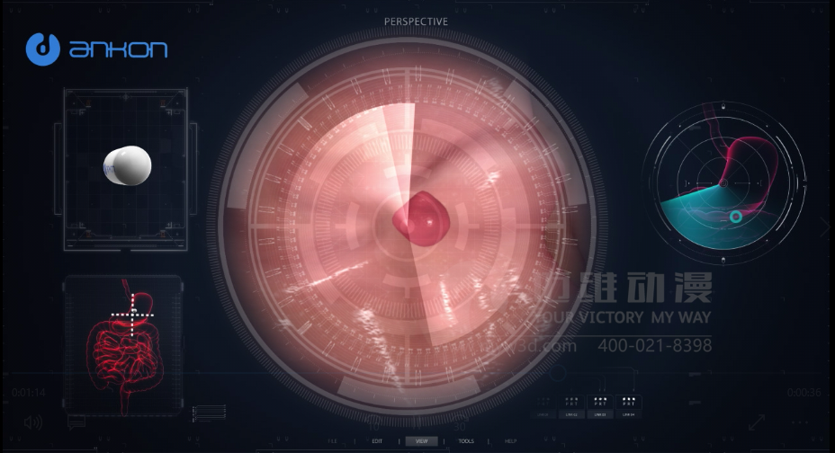 醫(yī)學(xué)醫(yī)療三維動畫 醫(yī)學(xué)醫(yī)療三維動畫