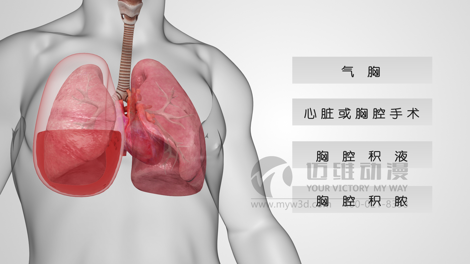 醫(yī)療器械動(dòng)畫.jpg 醫(yī)療器械動(dòng)畫.jpg