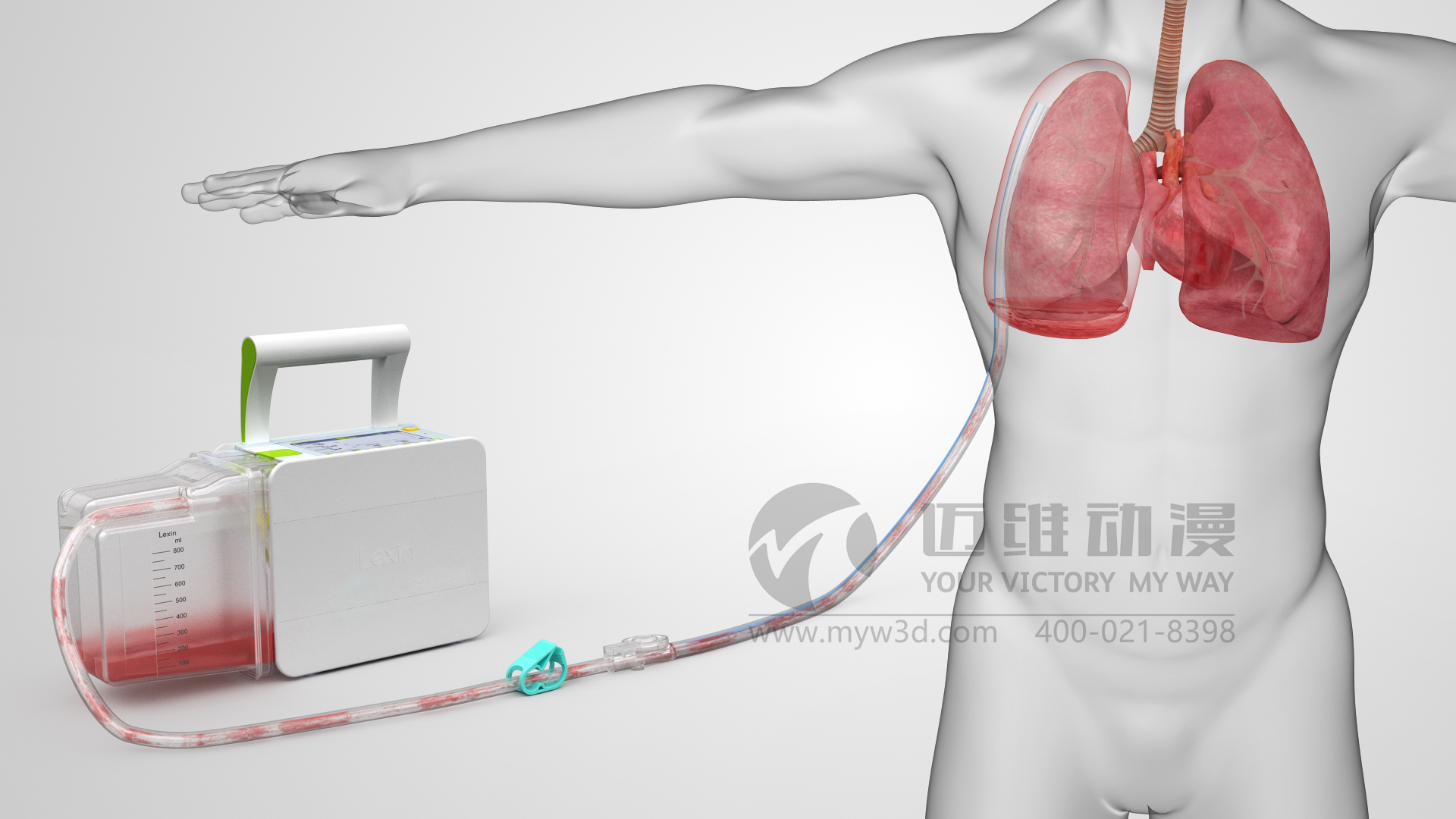 醫(yī)療器械動(dòng)畫.jpg 醫(yī)療器械動(dòng)畫.jpg