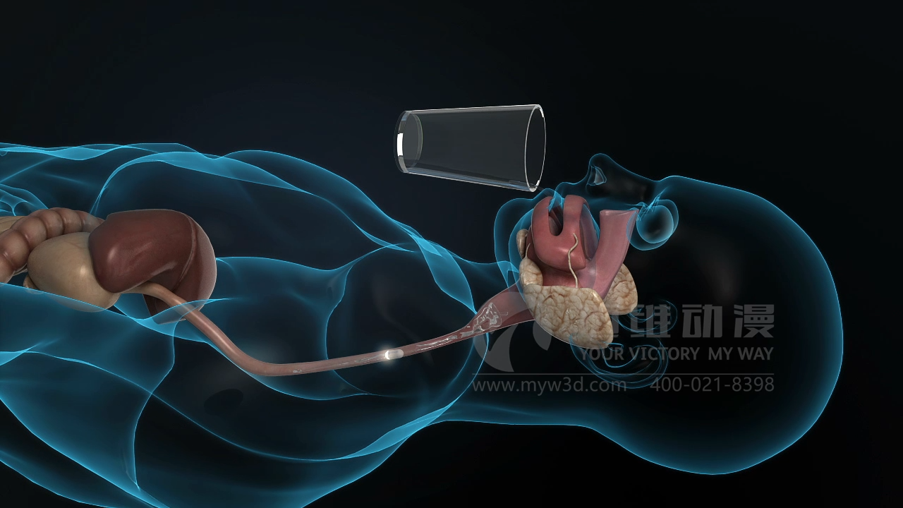 醫(yī)療三維動(dòng)畫(huà).png 醫(yī)療三維動(dòng)畫(huà).png