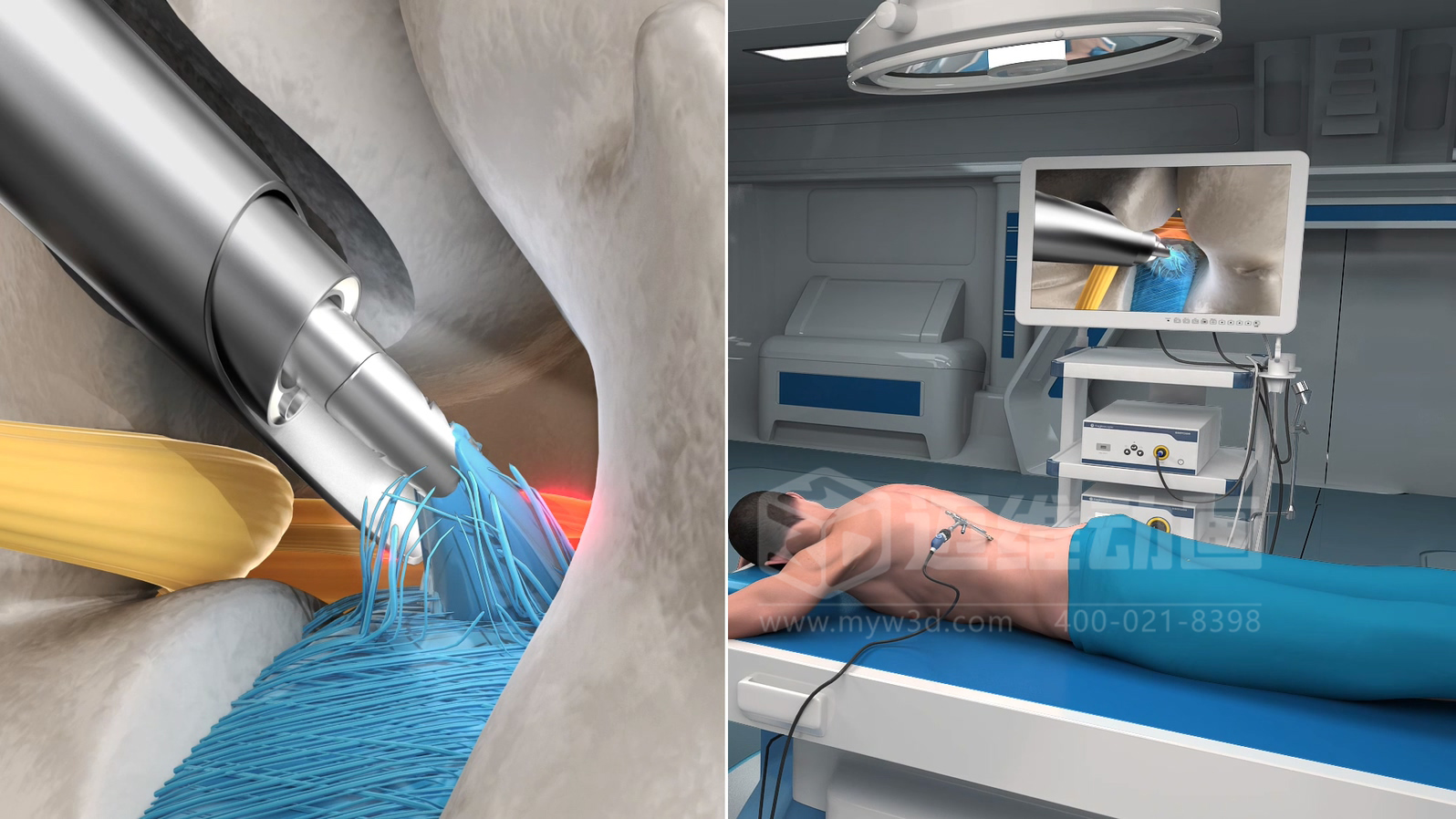 企業(yè)制作工程施工|自動(dòng)化生產(chǎn)線|產(chǎn)品演示|醫(yī)學(xué)行業(yè)三維動(dòng)畫要準(zhǔn)備哪些資料，以便有效地提供給三維動(dòng)畫制作公司呢？(圖7)