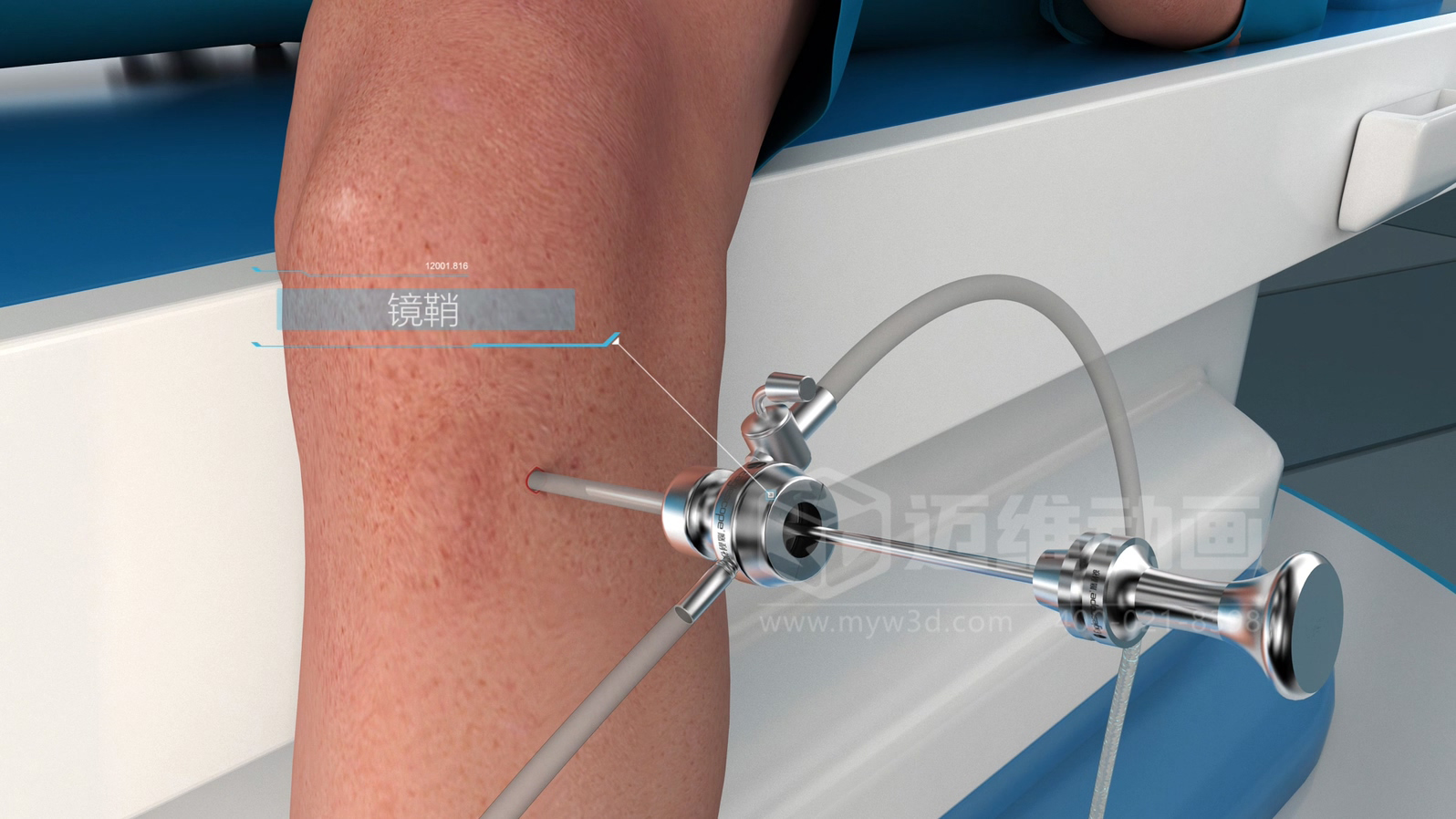 醫(yī)學(xué)手術(shù)三維動(dòng)畫(huà)制作公司哪家好？解碼上海邁維動(dòng)漫的醫(yī)學(xué)醫(yī)療3D可視化創(chuàng)新之路(圖2)