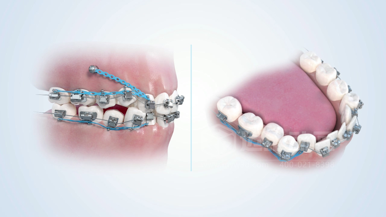 從實(shí)驗(yàn)室到手術(shù)室：邁維動(dòng)漫用三維動(dòng)畫，讓精密科技“看得見，懂得到”訂單轉(zhuǎn)化率提高 50%(圖10)