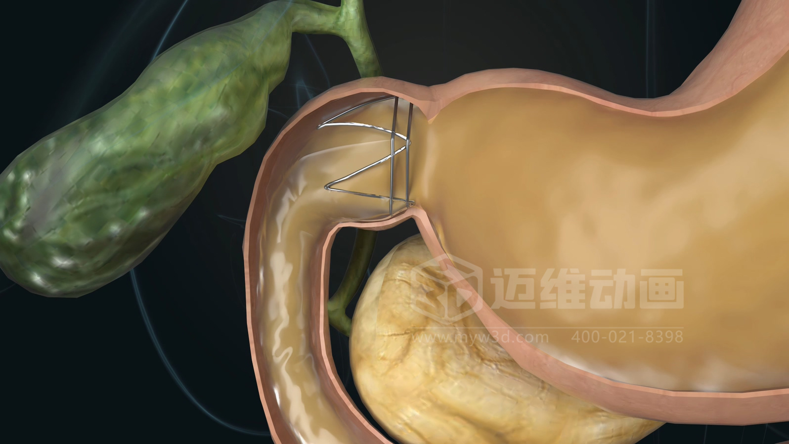 醫(yī)學(xué)科普從來不是 “天書”：三維動(dòng)畫讓復(fù)雜科學(xué)原理輕松 get！(圖12)