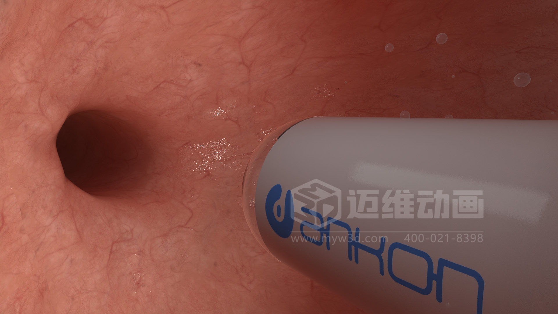 醫(yī)學(xué)檢測設(shè)備如何突破消化道檢查壁壘？三維動畫還原核心技術(shù)與臨床價(jià)值(圖4)